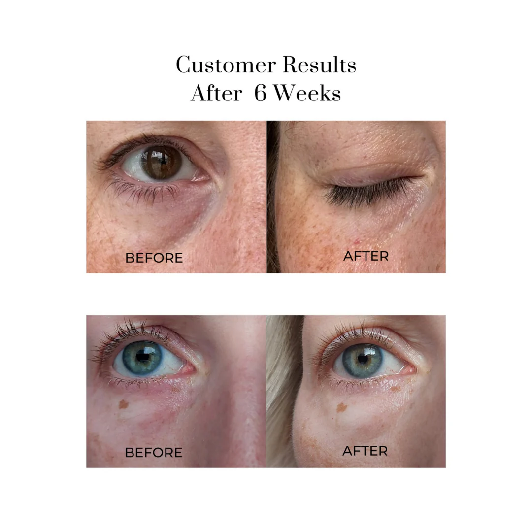 Eye Wonder Nutri-Active Eye Serum - Image 4