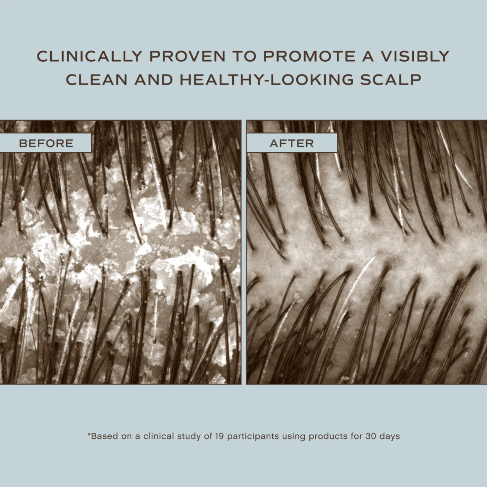 Hair Renew Scalp Balance Duo - Image 4